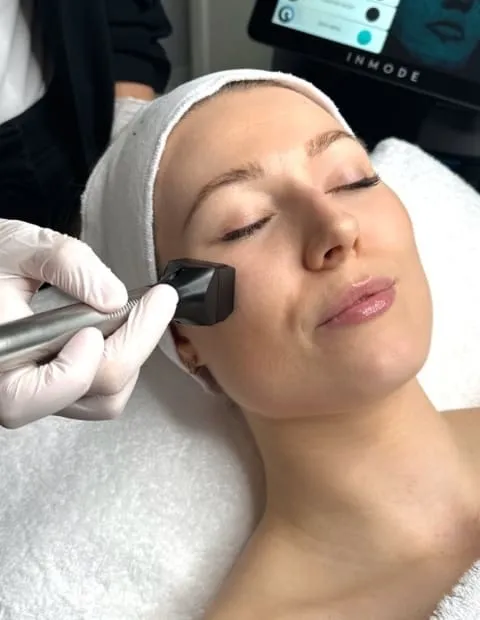 Benefits of a Forma Facial